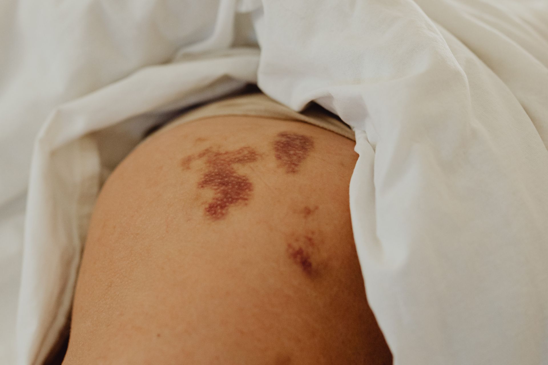 Choroby skóry – co trzeba o nich wiedzieć?